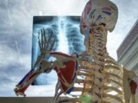 What Is Lumbar Support In A Chair? skeleton-2561573_960_720a-300×200